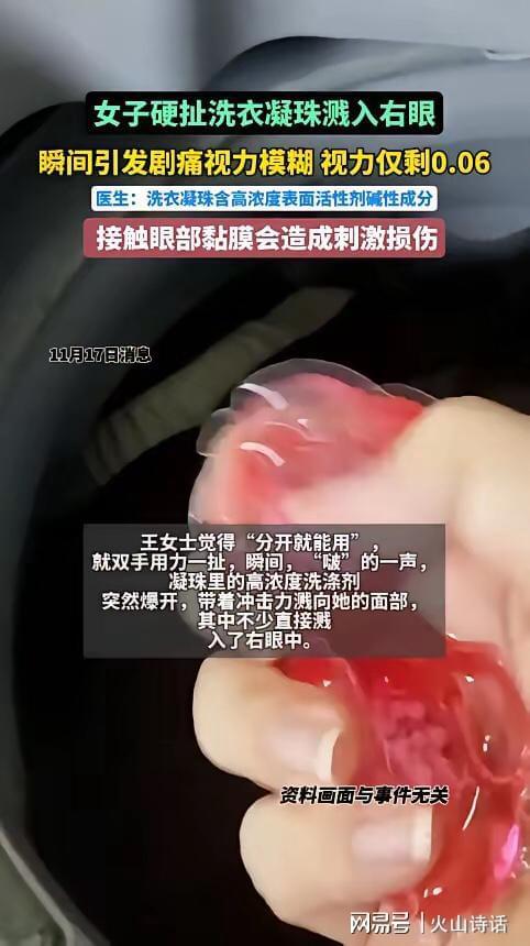 炸”杭州一女子撕扯凝珠发生意外致眼睛失明AG真人百家家乐平台恐怖！洗衣引发“爆(图2)